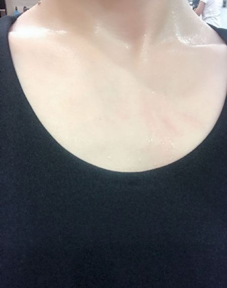 阳炎